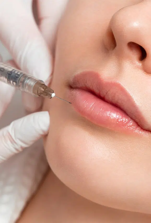 Photo of a woman getting dermal fillers injected into her lips