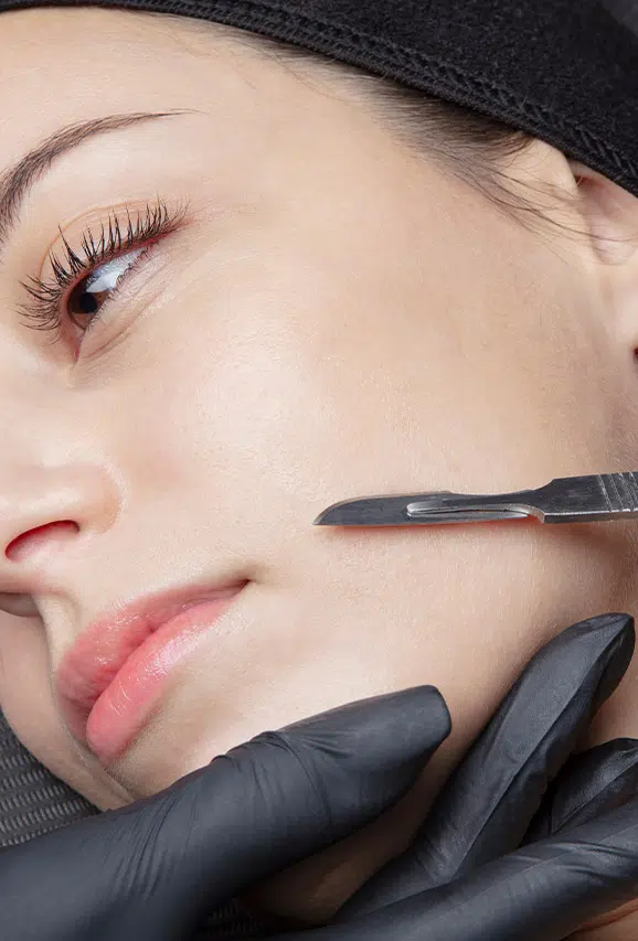 Photo of a woman getting dermaplaning treatments