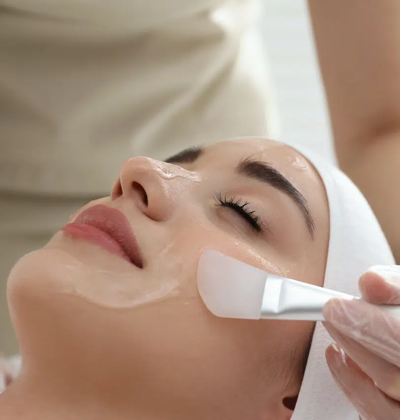Photo of a woman getting a chemical peel treatment