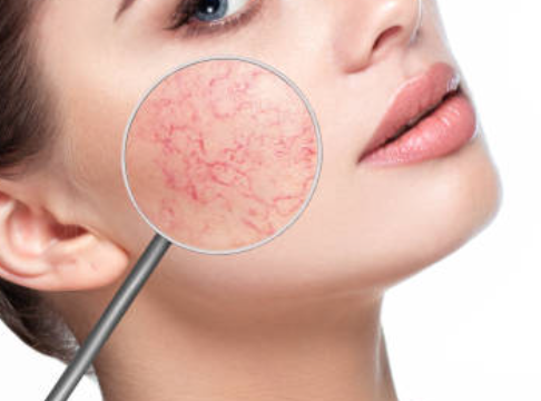 Facial Veins