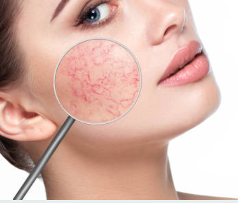 Facial Veins
